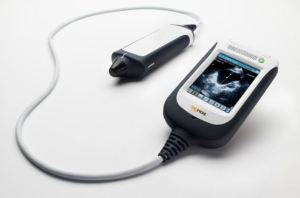 Signostics' Signos Personal Ultrasound Device